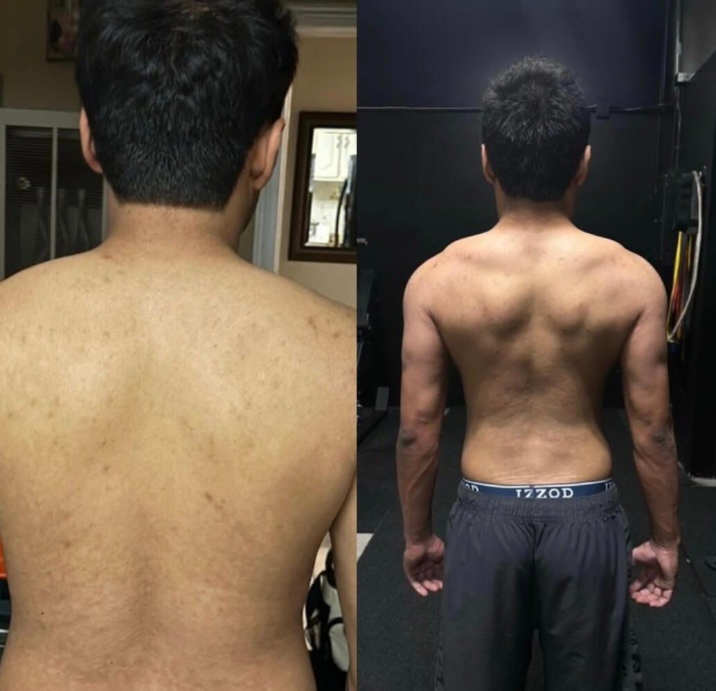 Body Recomp, Both 152 lbs